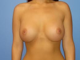 how to get bigger breast naturally